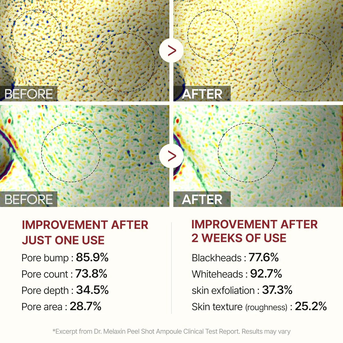 Sérum Peel Shot coréen